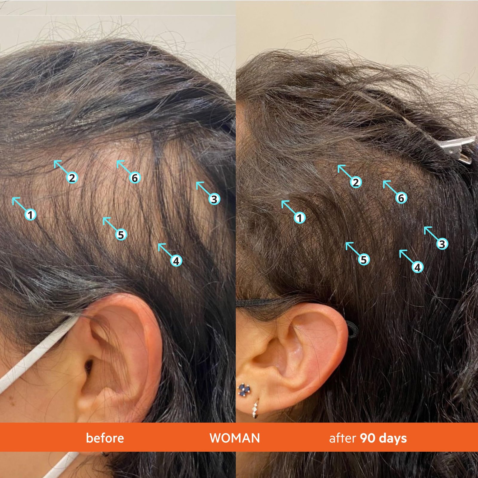 9195tZDiXnL.jpg DS Labs Revita Hair Density Shampoo - Image 4